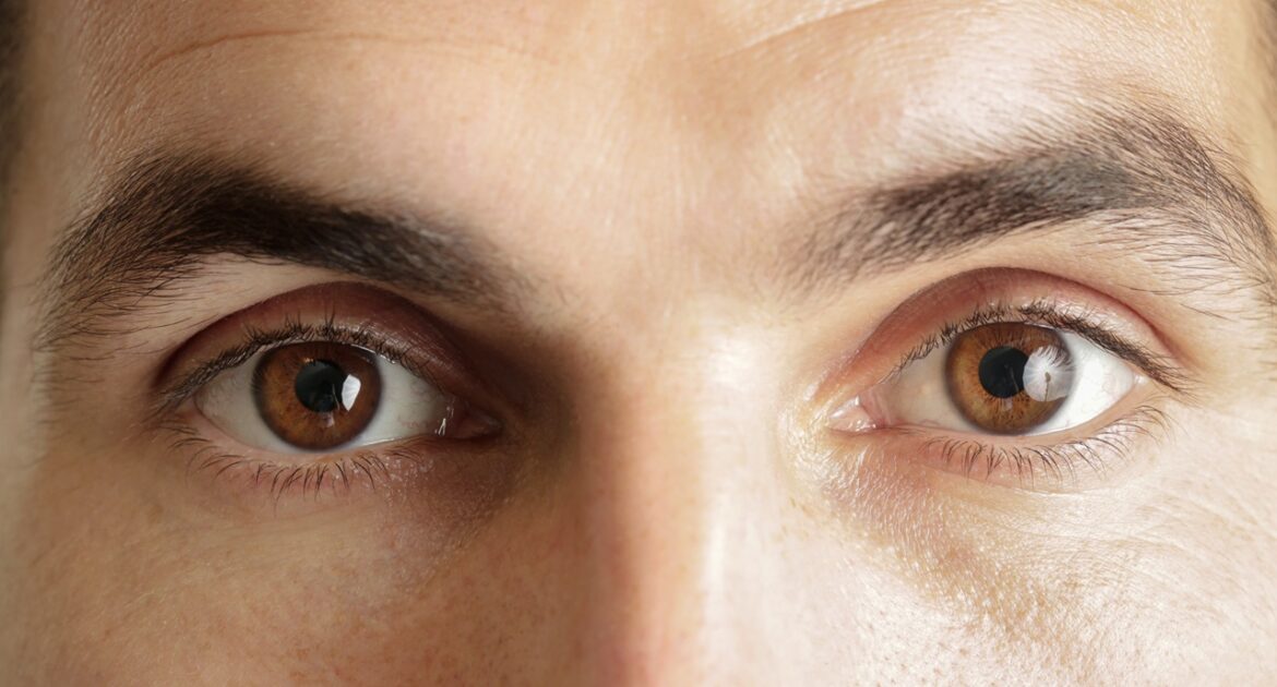 Lidstraffung Erlangen